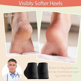 Moisturizing Socks for Women & Men – Gel Heel Socks for Dry Cracked Feet Treatment | Silicone Heel Protectors, Spa Moisturizing Heel Socks for Repairing (2 Pair)