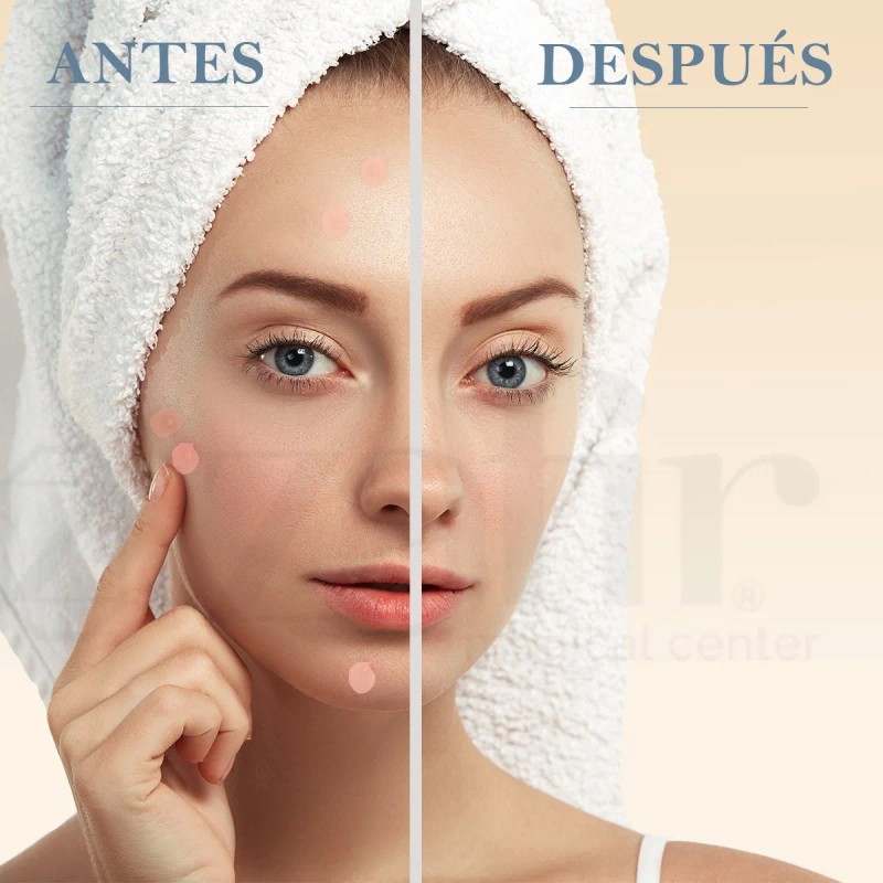 Loción Acne Drying Lotion M.A.D Skincare