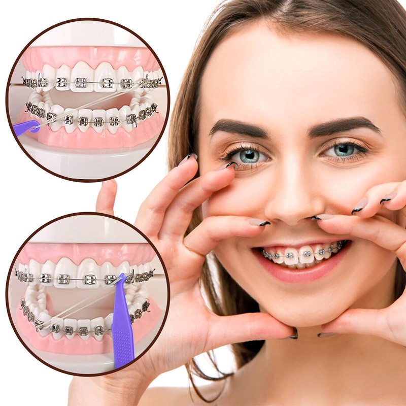 VEGCOO 1000 Pcs Orthodontic Elastic Rubber Bands, 3/16", Braces Teeth