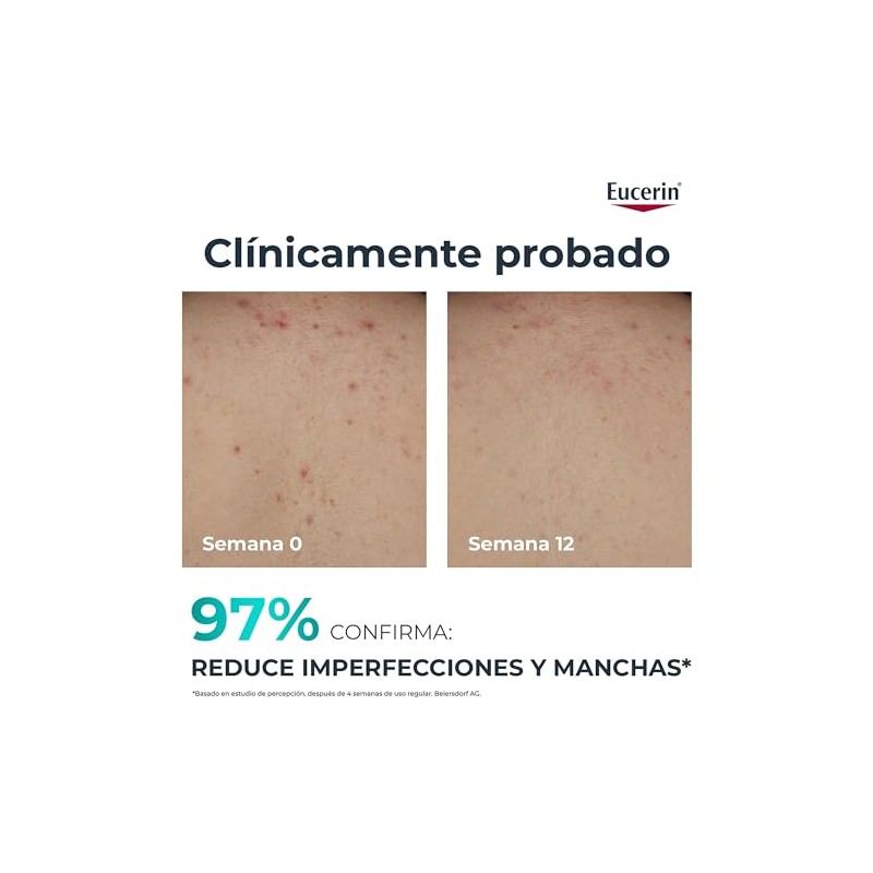 EUCERIN DermoPure Triple Effect Crema Corporal (200ml) Anti-Imperfecciones, Anti-Manchas, Anti-Brillo,