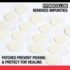 Neutrogena Stubborn Acne Ultra-Thin Blemish Dots, Pimple Patches for Face,