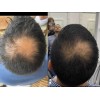 Shampoo Reviving Farmasi Caida Cabello