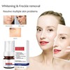 Vitamin C Serum, Niacinamide Serum Whitening and Freckles Removal, Reduced
