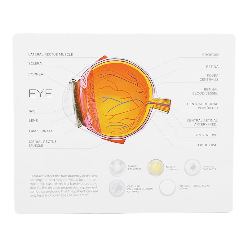 Enlarged Human Eye Anatomical Model Accurate Shows Optic Nerves Cornea
