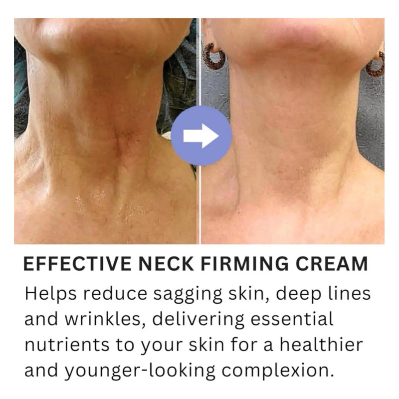 - 2×tighten & Lift Firming Neck Cream, Neck Firming Cream