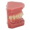 Tooth Model 28 Teeth Dental Orthodontic Model Teaching Study Supplies