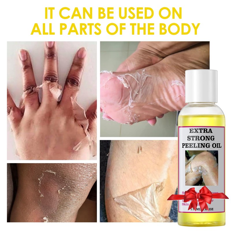 YAFUSIPE Yellow Peeling Oil for Dark Skin Strong Peel Oil