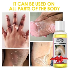 YAFUSIPE Yellow Peeling Oil for Dark Skin Strong Peel Oil Extra Strength Exfoliating Chemical Exfoliant Peels Solution at Home Body Peeling for Exfoliate Body Hand Foot Knuckle All Skin Type 3.66 OZ