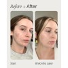 Kiehl's - Serum Kiehl's Collashot Plump 30 Ml - 30