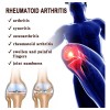 Xinnuo Crema Para La Artritis, Pomada Para Aliviar El Dolor