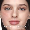 Cyzone - Skin First Sérum Anti Imperfecciones 19 Ml