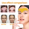 Forehead Wrinkle Remover Patch,Smooth Forehead And Smooth Fine Lines And