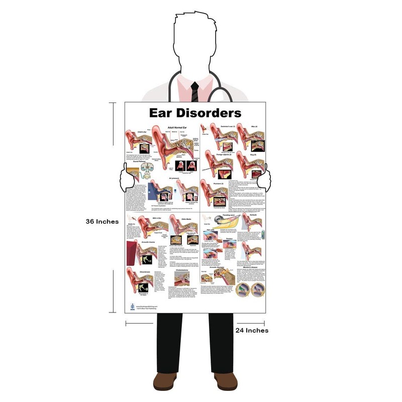Blue Tree Publishing Ear Disorders Poster 24x36inch, Otitis and Other