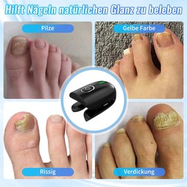 LaseLocks Nagelpilz Laser Behandlung Gerät, Tötet Pilz in den Nagel und tiefen Schichten der Haut, Wiederaufladbare tragbare Laser Therapie Gerät