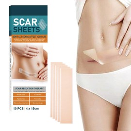雲見 傷跡ケアテープ 10枚入り ケロイド テープ 帝王切開 傷テープ 傷あとケア用シリコンジェルシート 手術後 傷隠しテープ 肌色 40mm×150mm