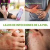 Jab?n en Barra Medicinal Antimic?tico, Tratamiento para la Ti?a Inguinal,