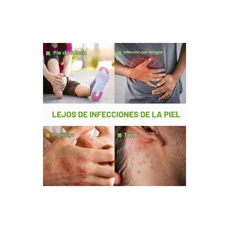 Jab?n en Barra Medicinal Antimic?tico, Tratamiento para la Ti?a Inguinal,