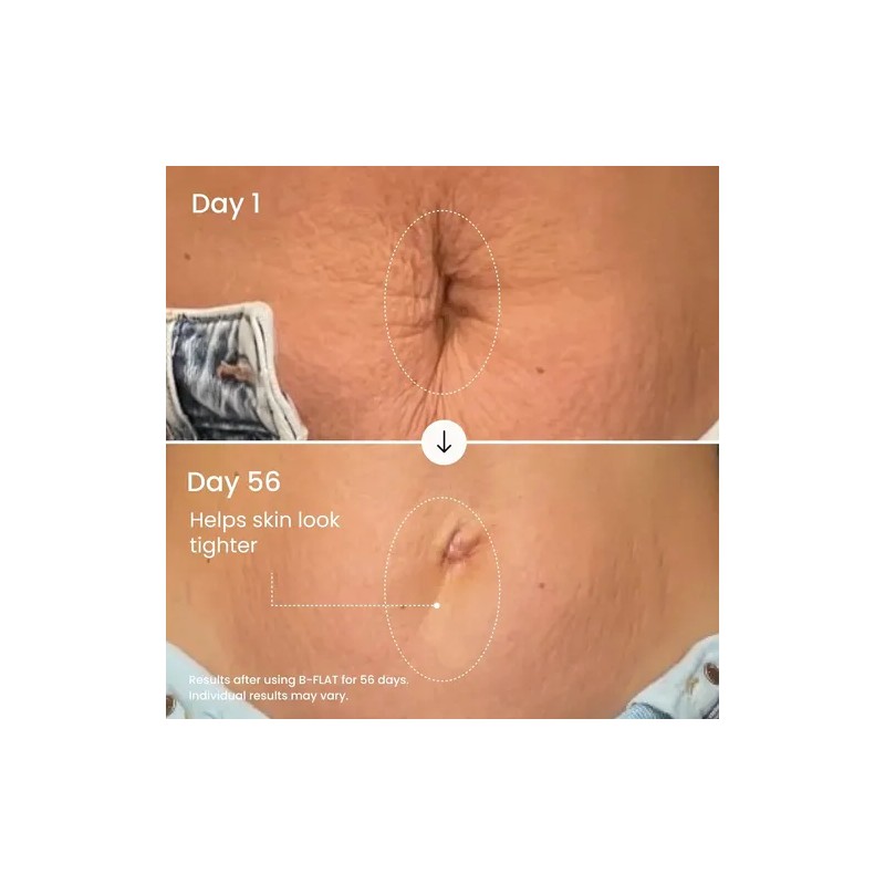 Crema Reafirmante Abdominal Maëlys B-flat Para Mujeres: Trat