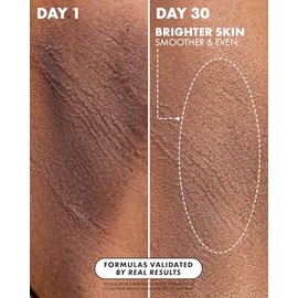 Truly- Tratamiento corporal con poción para cicatrices, tratamiento de pigmentos Beauty Jelly Booster, de rápida absorción para cicatrices de acné en 
