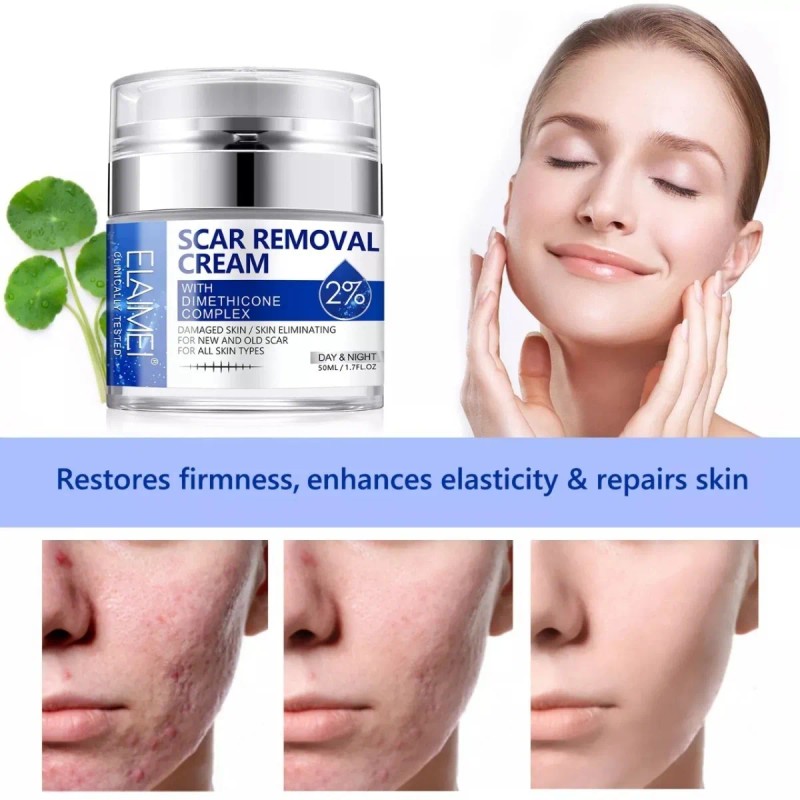 Crema/gel para cicatrices profundas, queloides, cacarizos