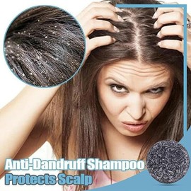 Gray Hair Reverse Bar,Reverse Grey Hair Bar Shampoo,Bamboo Charcoal Shampoo Soap,Gray White Hair Repair,Natural Hair Darkening Shampoo Bar,Hair Wash Soap Prevents Hair Loss (2)