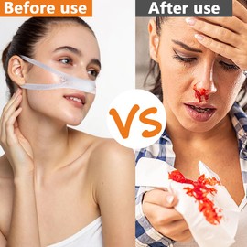 Nasal Bandage Dressing Holder, 2 Pcs Elastic Nose Bandages with 1 Roll Tape High Absorption Nasal Surgery Bandages Recovery Supplies Nasal Postoperative Supplies (White)