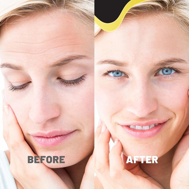 TOLEVITA - Forehead Wrinkle Patches | Forehead Lines Remover |