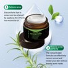 Tea Tree Anti-Acne Cream for Pimples, Blackheads and Blemishes -