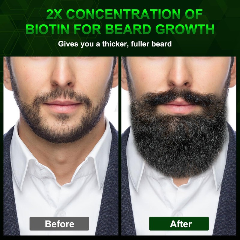 Beard Balm-2X Concentration Biotin -Styles, Growth, Strengthens & Softens Beards