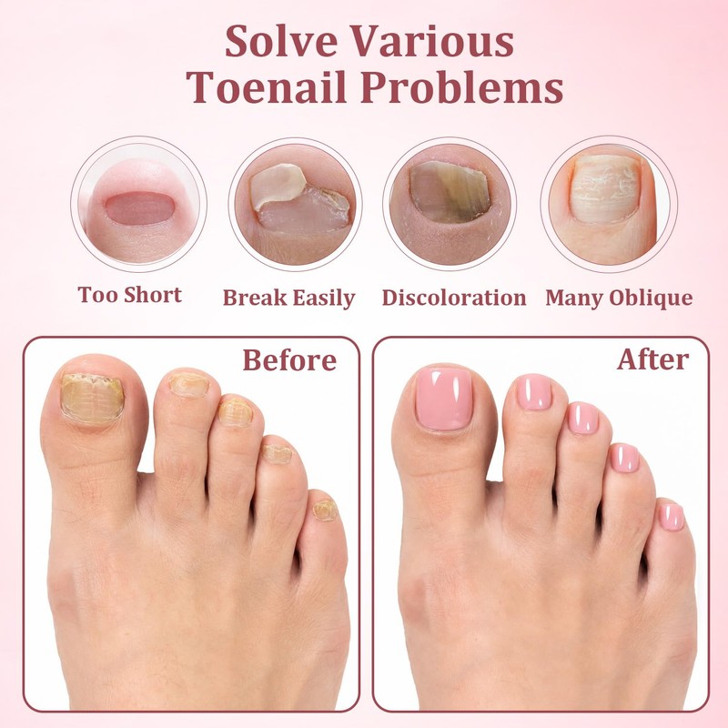 3 Colors Pink Clear White Poly Gel Nail Kit for