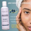 Controla El Acne Matifica Desinflama Rosacea Locion Azelaico Momento de