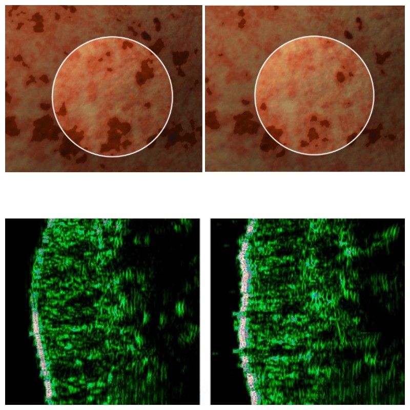 AROCELL Mela TXA Milky Drop Ampoule 30ml