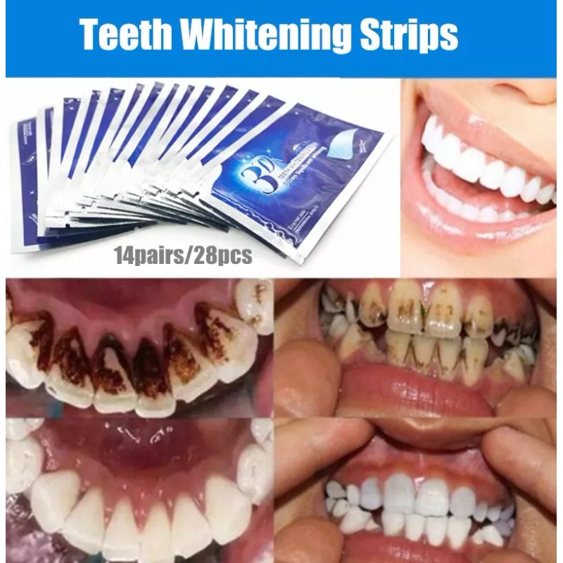 Best Versión Mejorada 3d Blanqueamiento Dental Pegatinas 14 Pares