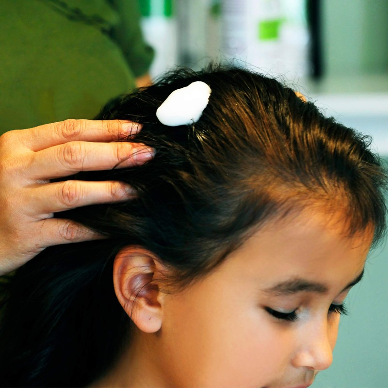 My Hair Helpers Natural Enzymes for Head Lice - Mousse