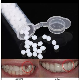 Reparación De Dientes, Sólido,temporal Duradero,reutilizable