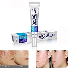 Bioaqua Crema Pure Skin Elimina Acné y Cicatrices Control De Grasa - 30ml
