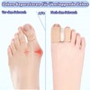 PWCTNT Zehenspreizer, Hallux Valgus Korrektur, 6 Stück Silikon Zehenspreizer Hallux