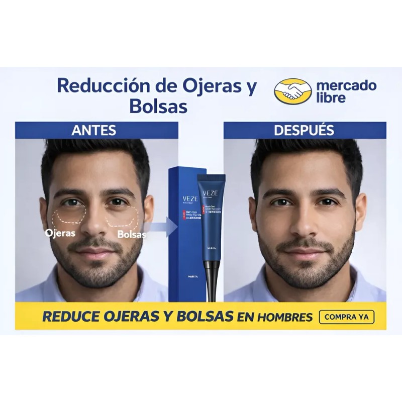 Serum Contorno Ojos Elimina Ojeras, Bolsas Para Hombre New