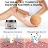 Strawberry Legs Treatment,Keratosis Pilaris Treatment,Skin Exfoliating Repair Lotion,Keratosis Pilaris Cream,Moisturizing
