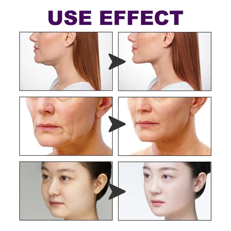 Parche Lifting Facial Reafirmante Invisible 60 Pcs