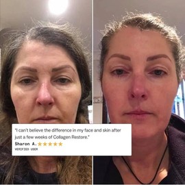 My Way Up Collagen Restore 270g