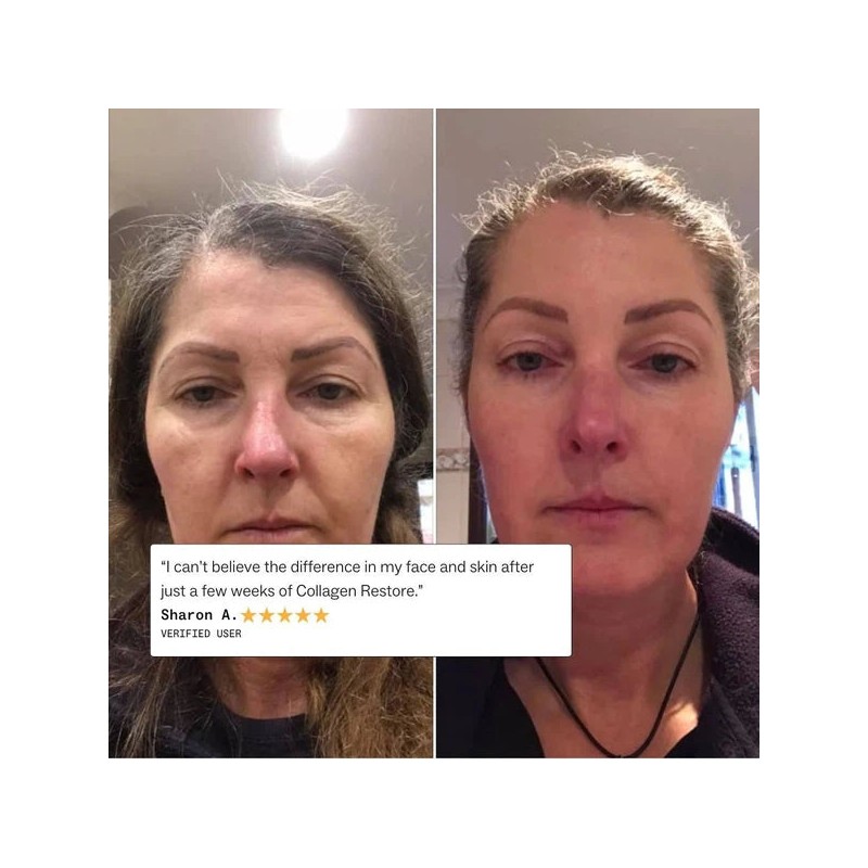 My Way Up Collagen Restore 270g