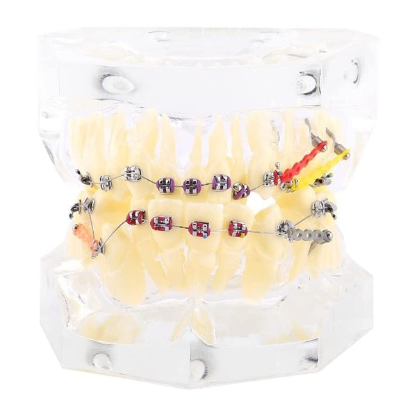 Akozon Dental Orthodontic Treatment Malocclusion Study Teeth Model with Wire Chain Dental Orthodontic Model