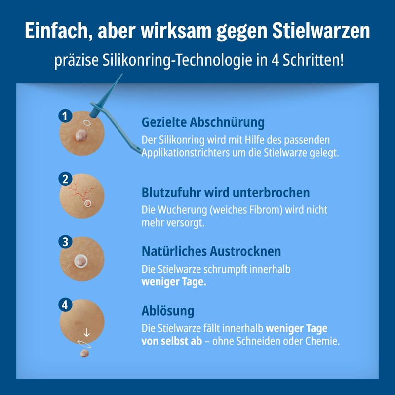 Evolsin anti-stem wart
