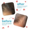 Artnaturals Gomitas Biotina 10000mcg - Crecimiento Cabello