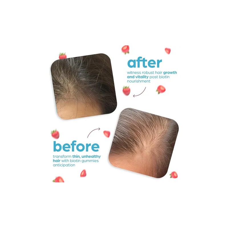 Artnaturals Gomitas Biotina 10000mcg - Crecimiento Cabello