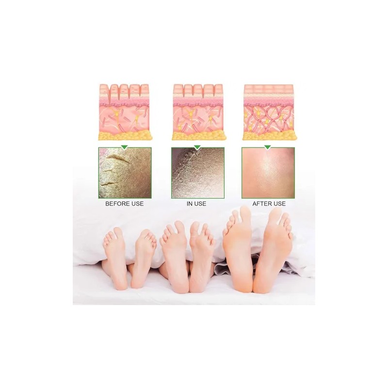 Crema De Urea Al 42%, Repara Pies Y Manos Secos