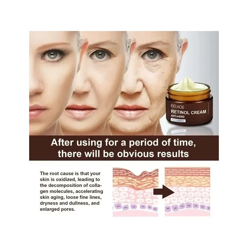 Ee Crema Retinol Anti Edad Anti Aging Reafirmante Hidratante