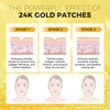 24K Gold Forehead Wrinkle Patches, with Aloe, Collagen, Vitamin E