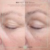 Isispharma Glyco-a Soft Peeling 30ml